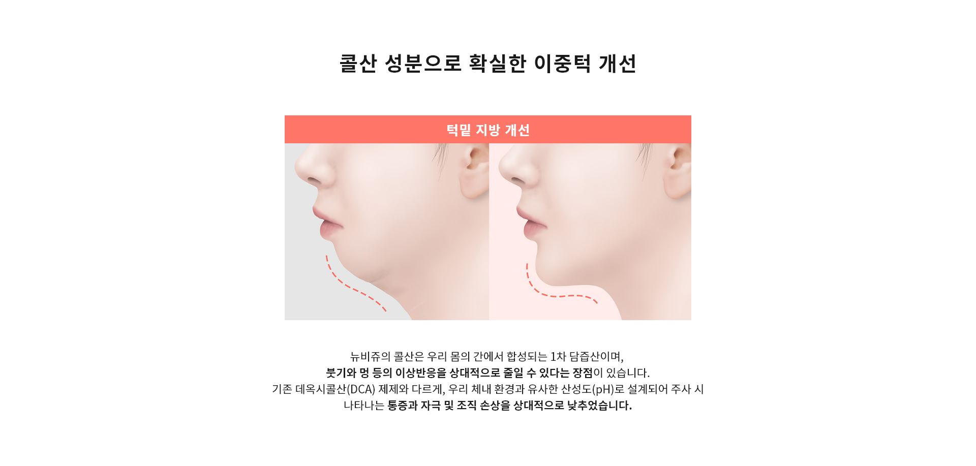 콜산 성분으로 확실한 이중턱 개선